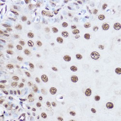 U4/U6.U5 Tri-SnRNP-Associated Protein 1 (SART1) Antibody