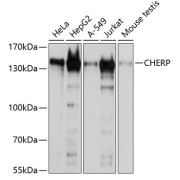 Western blot analysis of various lysates using CHERP Antibody at 1/1000 dilution. Secondary antibody: HRP-conjugated Goat anti-Rabbit IgG (H+L) at 1/10000 dilution. Lysates/proteins: 25 µg per lane. Blocking buffer: 3% nonfat dry milk in TBST. Exposure time: 60s.