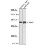 Western blot analysis of various lysates using THBS2 Antibody at 1/1000 dilution. Secondary antibody: HRP-conjugated Goat anti-Rabbit IgG (H+L) at 1/10000 dilution. Lysates/proteins: 25 µg per lane. Blocking buffer: 3% nonfat dry milk in TBST. Exposure time: 90s.