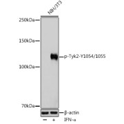 Western blot analysis of lysates from NIH/3T3 cells, using Phospho-Tyk2-Y1054/1055 Antibody at 1/1000 dilution. NIH/3T3 cells were treated by IFN-α (100 ng/ml) at 37 °C for 30 minutes after serum-starvation overnight. Secondary antibody: HRP-conjugated Goat anti-Rabbit IgG (H+L) at 1/10000 dilution. Lysates/proteins: 25 µg per lane. Blocking buffer: 3% BSA. Exposure time: 180s.