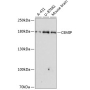 Western blot analysis of various lysates using CEMIP Antibody at 1/3000 dilution. Secondary antibody: HRP-conjugated Goat anti-Rabbit IgG (H+L) at 1/10000 dilution. Lysates/proteins: 25 µg per lane. Blocking buffer: 3% nonfat dry milk in TBST. Exposure time: 90s.