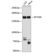 Western blot analysis of various lysates using ZFYVE9 Antibody at 1/1000 dilution. Secondary antibody: HRP-conjugated Goat anti-Rabbit IgG (H+L) at 1/10000 dilution. Lysates/proteins: 25 µg per lane. Blocking buffer: 3% nonfat dry milk in TBST. Exposure time: 20s.