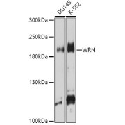 Western blot analysis of various lysates using WRN Antibody at 1/1000 dilution. Secondary antibody: HRP-conjugated Goat anti-Rabbit IgG (H+L) at 1/10000 dilution. Lysates/proteins: 25 µg per lane. Blocking buffer: 3% nonfat dry milk in TBST. Exposure time: 15s.