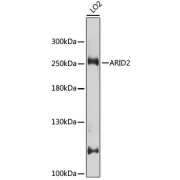 Western blot analysis of lysates from LO2 cells, using ARID2 Antibody at 1/1000 dilution. Secondary antibody: HRP-conjugated Goat anti-Rabbit IgG (H+L) at 1/10000 dilution. Lysates/proteins: 25 µg per lane. Blocking buffer: 3% nonfat dry milk in TBST. Exposure time: 30s.