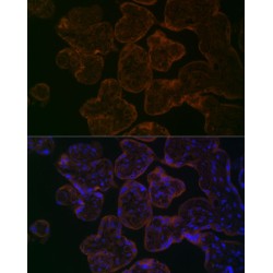 Unconventional Myosin-Vb (MYO5B) Antibody