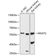 Western blot analysis of various lysates using MGAT2 Antibody at 1/1000 dilution. Secondary antibody: HRP-conjugated Goat anti-Rabbit IgG (H+L) at 1/10000 dilution. Lysates/proteins: 25 µg per lane. Blocking buffer: 3% nonfat dry milk in TBST. Exposure time: 90s.