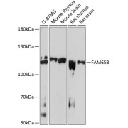 Western blot analysis of various lysates using FAM65B Antibody at 1/3000 dilution. Secondary antibody: HRP-conjugated Goat anti-Rabbit IgG (H+L) at 1/10000 dilution. Lysates/proteins: 25 µg per lane. Blocking buffer: 3% nonfat dry milk in TBST. Exposure time: 90s.