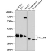 Western blot analysis of various lysates using GLOD4 Antibody at 1/3000 dilution. Secondary antibody: HRP-conjugated Goat anti-Rabbit IgG (H+L) at 1/10000 dilution. Lysates/proteins: 25 µg per lane. Blocking buffer: 3% nonfat dry milk in TBST. Exposure time: 90s.