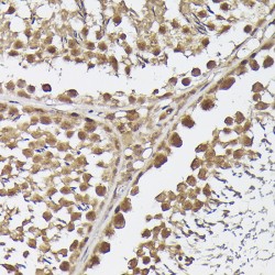 Methyltransferase Like Protein 4 (METTL4) Antibody