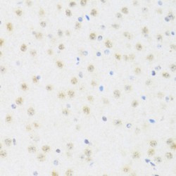 ATP-Dependent RNA Helicase DDX50 (DDX50) Antibody