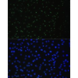 ATP-Dependent RNA Helicase DDX50 (DDX50) Antibody