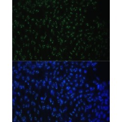 ATP-Dependent RNA Helicase DDX50 (DDX50) Antibody