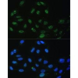ATP-Dependent RNA Helicase DDX50 (DDX50) Antibody
