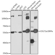 Western blot analysis of various lysates using CD172a/SIRPα Antibody at 1/1000 dilution. Secondary antibody: HRP-conjugated Goat anti-Rabbit IgG (H+L) at 1/10000 dilution. Lysates/proteins: 25 µg per lane. Blocking buffer: 3% nonfat dry milk in TBST. Exposure time: 1s.