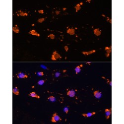Signal Regulatory Protein Alpha (SIRPA) Antibody