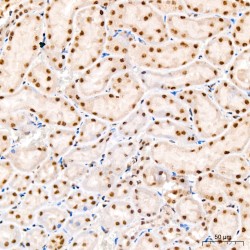 JNK1 / 2 / 3 p(T183 / T183 / T221) Antibody