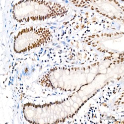JNK1 / 2 / 3 p(T183 / T183 / T221) Antibody