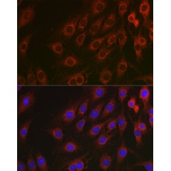 Transcription Factor p65 / NFKB3 (RELA) Antibody