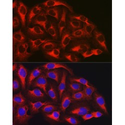 Transcription Factor p65 / NFKB3 (RELA) Antibody