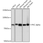 Western blot analysis of various lysates using PKC alpha antibody at 1/1000 dilution. Secondary antibody: HRP-conjugated Goat anti-Rabbit IgG (H+L) at 1/10000 dilution. Lysates/proteins: 25 µg per lane. Blocking buffer: 3% nonfat dry milk in TBST. Exposure time: 1s.