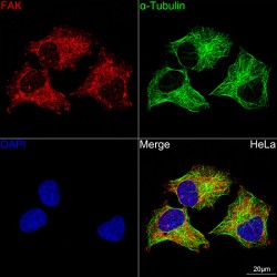 Protein Tyrosine Kinase 2 Beta (PTK2) Antibody