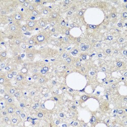 Alpha-Fetoprotein (AFP) Antibody