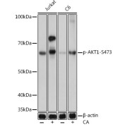 abx125440