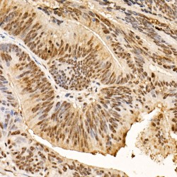 RAC-Alpha Serine/threonine-Protein Kinase Phospho-Ser473 (Akt1 pS473) Antibody
