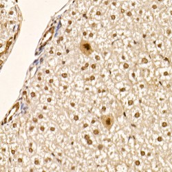 RAC-Alpha Serine/threonine-Protein Kinase Phospho-Ser473 (Akt1 pS473) Antibody
