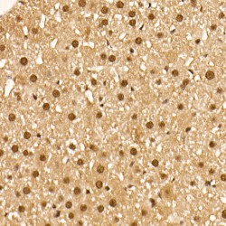RAC-Alpha Serine/threonine-Protein Kinase Phospho-Ser473 (Akt1 pS473) Antibody