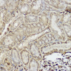 ATP-Dependent Translocase ABCB1 (ABCB1) Antibody
