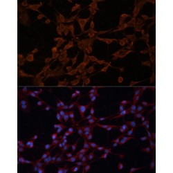 ATP-Dependent Translocase ABCB1 (ABCB1) Antibody