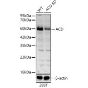 Western blot analysis of lysates from wild type(WT) and ACD knockdown (KD) 293T(KD) cells, using ACD Antibody at 1/1000 dilution. Secondary antibody: HRP-conjugated Goat anti-Rabbit IgG (H+L) at 1/10000 dilution. Lysates/proteins: 25 µg per lane. Blocking buffer: 3% nonfat dry milk in TBST. Exposure time: 60s.