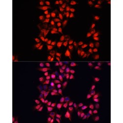 ADAM Metallopeptidase Domain 10 (ADAM10) Antibody