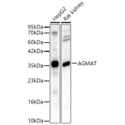 Western blot analysis of various lysates, using AGMAT Antibody at 1/2000 dilution. Secondary antibody: HRP-conjugated Goat anti-Rabbit IgG (H+L) at 1/10000 dilution. Lysates/proteins: 25 µg per lane. Blocking buffer: 3% nonfat dry milk in TBST. Exposure time: 45s.