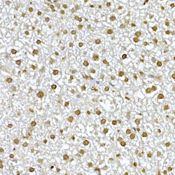 RAC-Alpha Serine/threonine-Protein Kinase (AKT1) Antibody