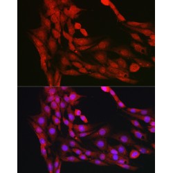 RAC-Alpha Serine/threonine-Protein Kinase (AKT1) Antibody