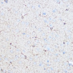 Aldolase C, Fructose Bisphosphate (ALDOC) Antibody