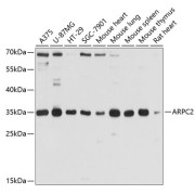 Western blot analysis of various lysates using ARPC2 Antibody at 1/1000 dilution. Secondary antibody: HRP-conjugated Goat anti-Rabbit IgG (H+L) at 1/10000 dilution. Lysates/proteins: 25 µg per lane. Blocking buffer: 3% nonfat dry milk in TBST. Exposure time: 15s.
