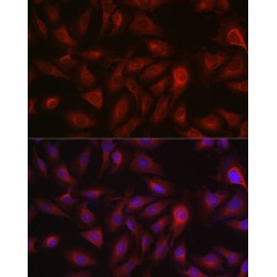 Bcl2 Associated X Protein (BAX) Antibody