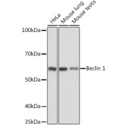 Western blot analysis of various lysates using Beclin 1 Antibody at 1/1000 dilution. Secondary antibody: HRP-conjugated Goat anti-Rabbit IgG (H+L) at 1/10000 dilution. Lysates/proteins: 25 µg per lane. Blocking buffer: 3% nonfat dry milk in TBST. Exposure time: 30s.