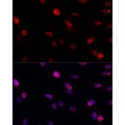 abx125574