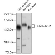 Western blot analysis of various lysates using CACNA2D2 Antibody at 1/1000 dilution. Secondary antibody: HRP-conjugated Goat anti-Rabbit IgG (H+L) at 1/10000 dilution. Lysates/proteins: 25 µg per lane. Blocking buffer: 3% nonfat dry milk in TBST. Exposure time: 1s.
