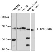 Western blot analysis of various lysates using CACNA2D3 Antibody at 1/3000 dilution. Secondary antibody: HRP-conjugated Goat anti-Rabbit IgG (H+L) at 1/10000 dilution. Lysates/proteins: 25 µg per lane. Blocking buffer: 3% nonfat dry milk in TBST. Exposure time: 10s.