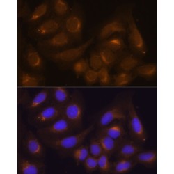 Caspase 9 (CASP9) Antibody