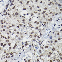 Cyclin-K (CCNK) Antibody