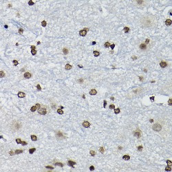Cyclin-K (CCNK) Antibody