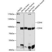 Western blot analysis of various lysates using CDH4 Antibody at 1/1000 dilution. Secondary antibody: HRP-conjugated Goat anti-Rabbit IgG (H+L) at 1/10000 dilution. Lysates/proteins: 25 µg per lane. Blocking buffer: 3% nonfat dry milk in TBST. Exposure time: 10s.