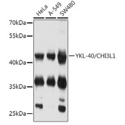 Western blot analysis of various lysates using YKL-40/CHI3L1 Antibody at 1/2000 dilution. Secondary antibody: HRP-conjugated Goat anti-Rabbit IgG (H+L) at 1/10000 dilution. Lysates/proteins: 25 µg per lane. Blocking buffer: 3% nonfat dry milk in TBST. Exposure time: 3s.