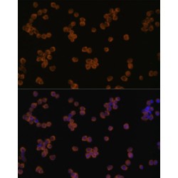 Chitinase-3-Like Protein 1 (CHI3L1) Antibody